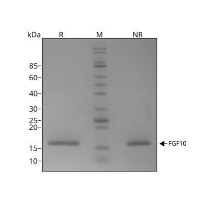 Human FGF-10 Qk003 protein purity SDS-PAGE lot #010