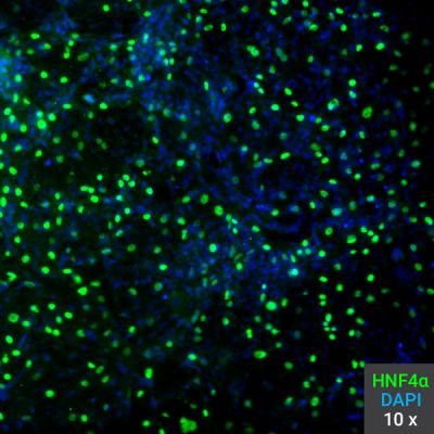 Human HGF NK1 Qk013 protein purity hepatocyte-like cell lot #010