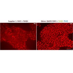 QK010 TGF-beta-1-PLUS Nanog expression in iPSC culture