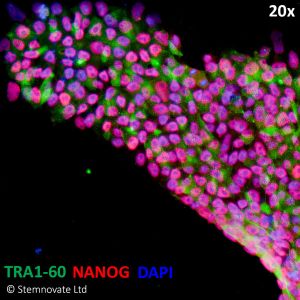 QK010 TGFB1 PLUS stained with RA160 Nanog stem cell iPSC