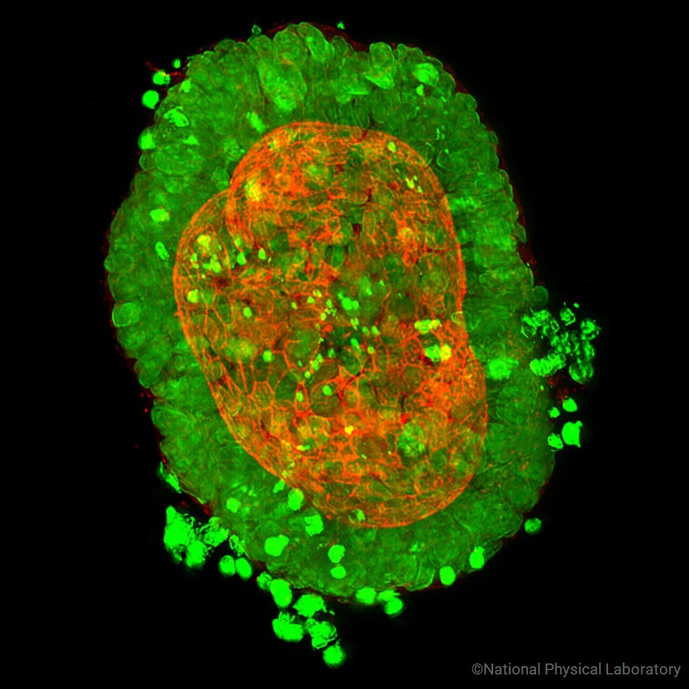 CRC organoid. Images prod National Physical Laboratory