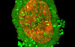 CRC organoid. Images prod National Physical Laboratory