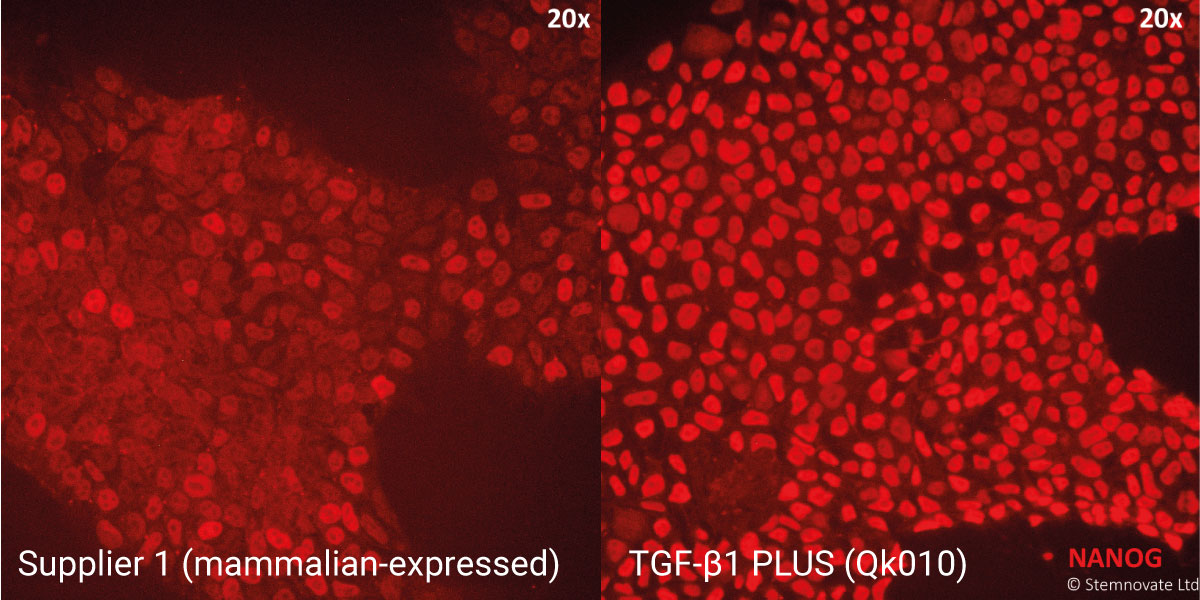 TGF beta 1 PLUS comparison