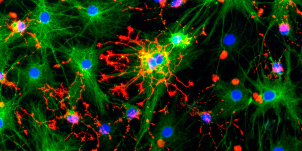 Neural stem cell culture using recombinant growth factors and cytokines