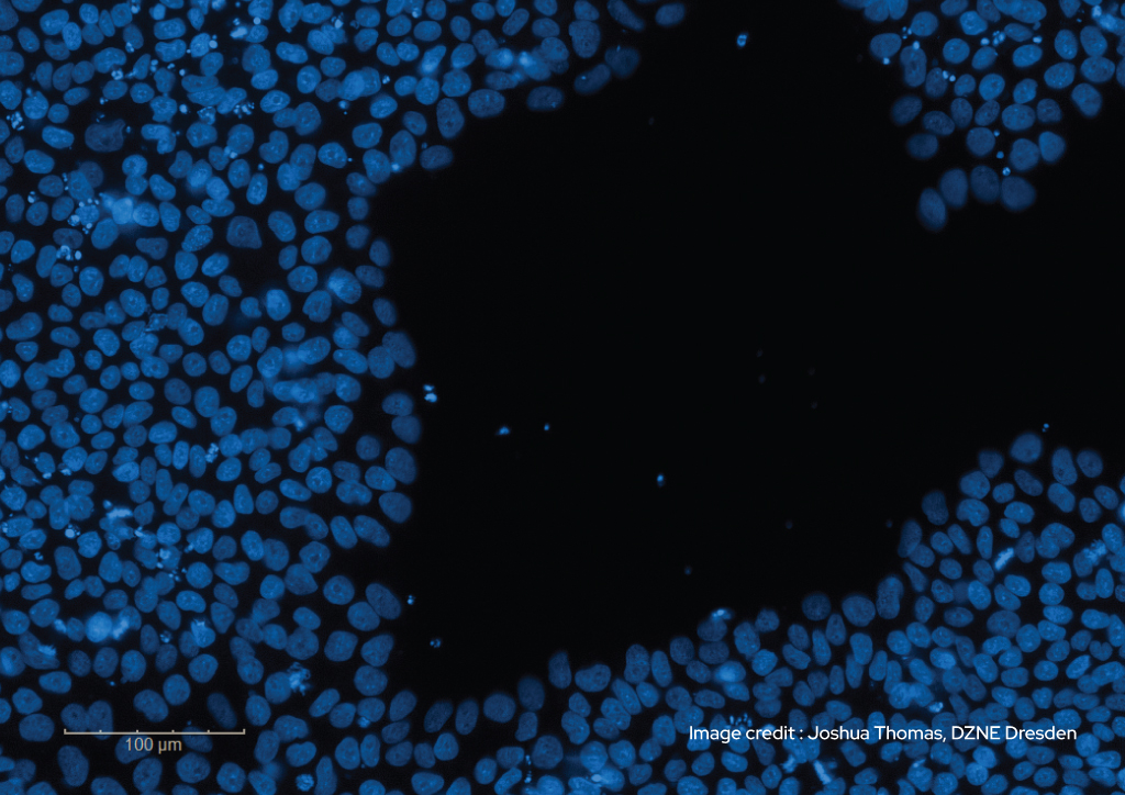 Joshua Thomas - iPSCs cultured in mTeSR™1 medium + Qkine FGF2-G3 for 3 days without a media change