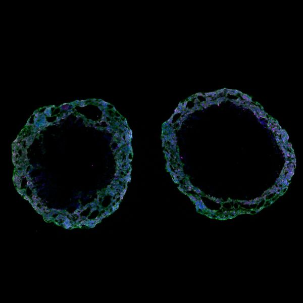 cardiac-organoid-image-2