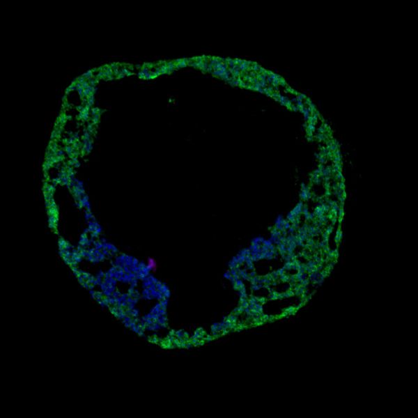 cardiac-organoid-image-1