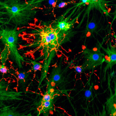 Recombinant proteins for neural stem cell culture