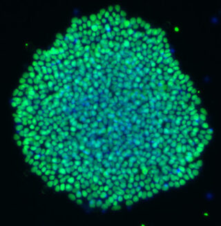 Qkine-StemCultures-iPSC culture-FGF2-SOX2-Hoechst