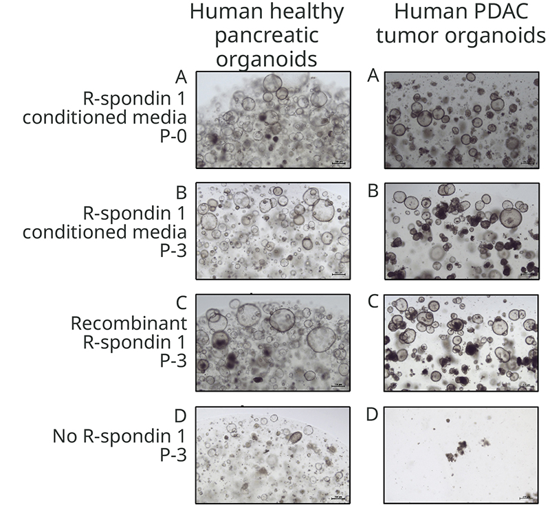 R-spondin-1 (Qk006) replaces R-spondin conditioned media to support growth of pancreatic cancer organoids