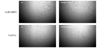 Wound healing assay Qkine TGF beta 1 stimulated would healing