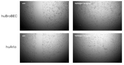 Migration assay images