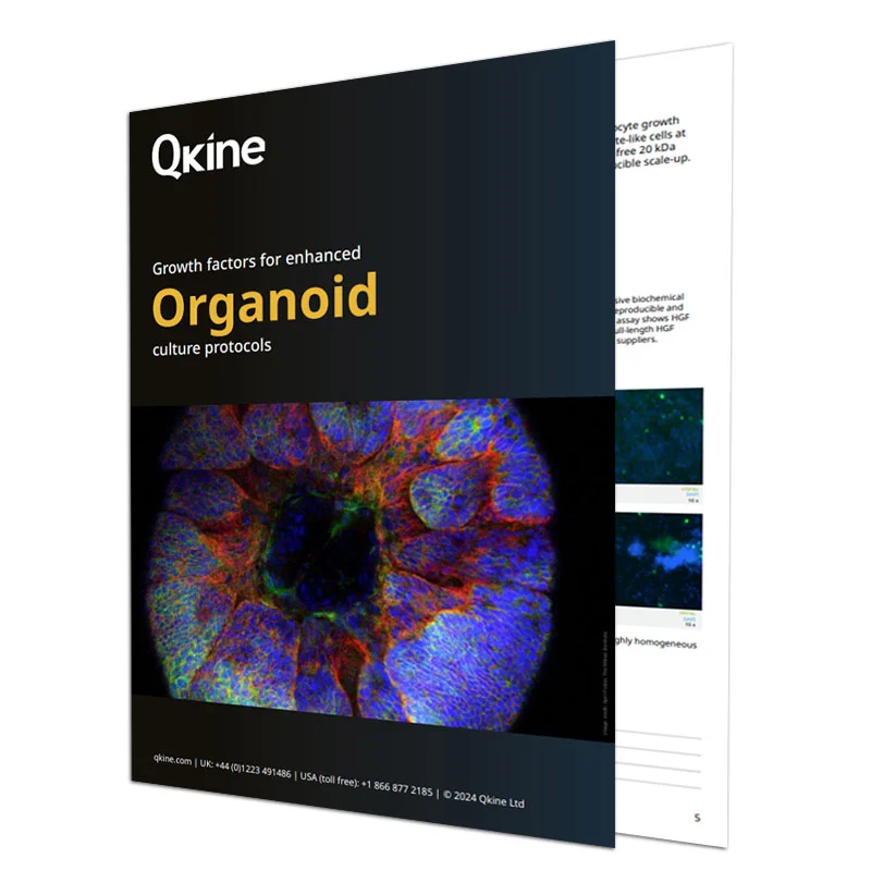 https://421795589.r.directcdn.net/wp-content/uploads/2024/05/Qkine_SSD_Organoid_Brochure_05.24.pdf