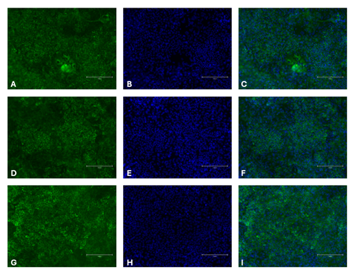 Immunocytochemistry of Hepatocellular markers in differentiated iPSCs